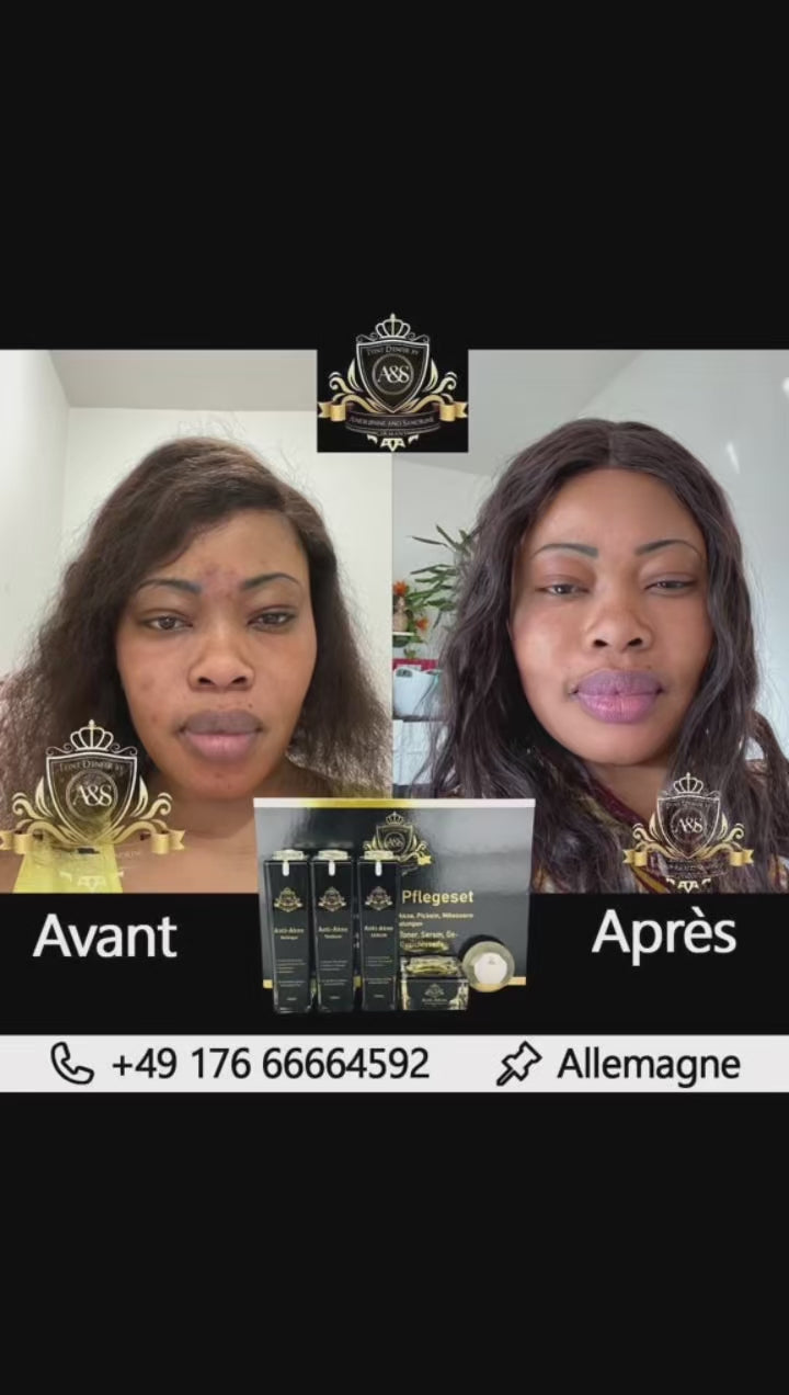 Holistic facial care for all skin types – including acne, blemishes, and sensitive skin.